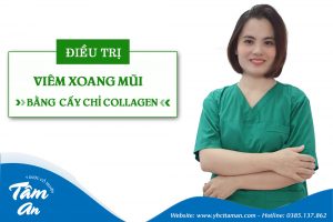 Thạc sĩ Bác sĩ Trần Phương Thủy – Bàn tay vàng cấy chỉ chữa viêm xoang mũi