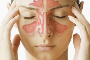 Những sai lầm khiến bệnh viêm xoang, viêm mũi ngày càng nặng