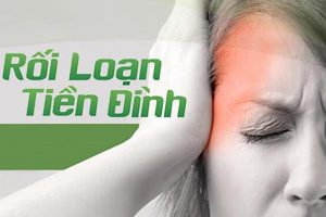 Phác đồ điều trị rối loạn tiền đình