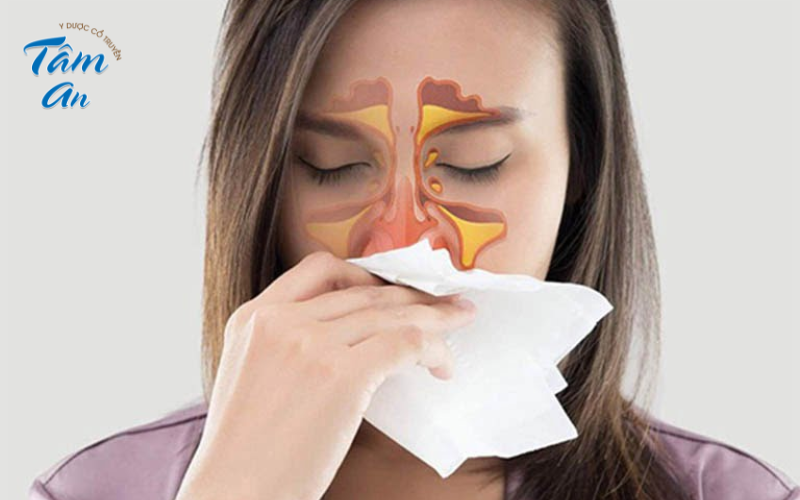 Không được chủ quan với bệnh viêm mũi dị ứng - Hình 3