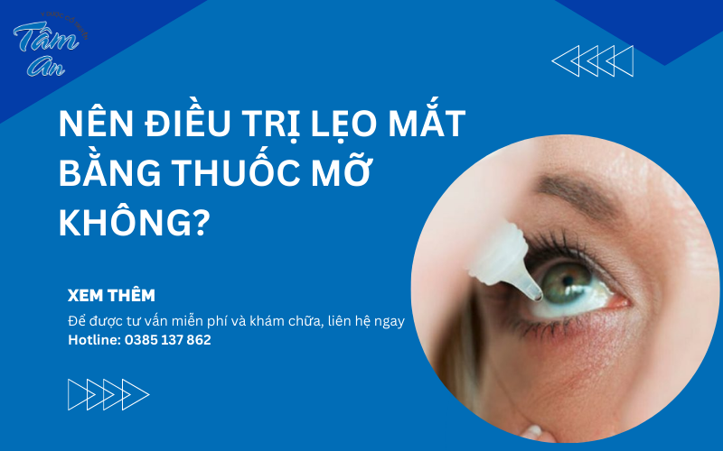 Nên điều trị lẹo mắt bằng thuốc mỡ không? - Hình 1