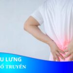 Y học cổ truyền điều trị đau lưng bằng những phương pháp nào?