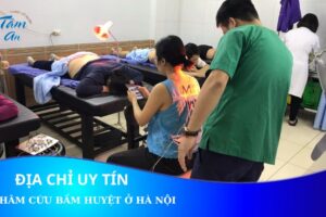 Địa chỉ châm cứu bấm huyệt uy tín nhất tại Hà Nội