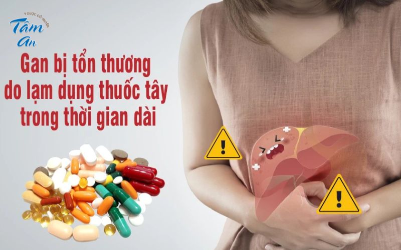 Sai lầm của người Việt: Lạm dụng thuốc Tây giảm đau xương khớp - Hình 2