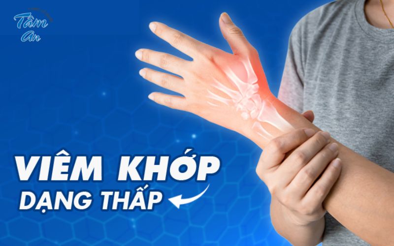 Đối tượng cần cảnh giác với nguy cơ mắc viêm khớp dạng thấp - Hình 2