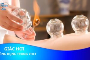 Giác hơi và những công dụng trong y học cổ truyền