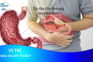 Đau dạ dày ở vị trí nào?