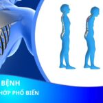 Top 6 căn bệnh xương khớp phổ biến ở người Việt Nam