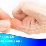 Viêm đau khớp ngón tay: Nguyên nhân, triệu chứng và cách điều trị