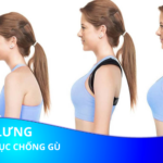 Gù lưng là gì? Tập thể dục có chống gù lưng không?