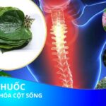 3 Bài thuốc dân gian chữa vôi hóa cột sống lưng cực hay