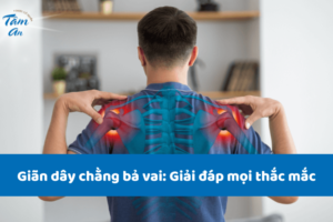 Giãn dây chằng bả vai: Giải đáp mọi thắc mắc
