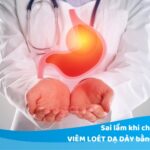 Sai lầm cần tránh khi chữa viêm loét dạ dày bằng thảo dược