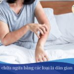 Cách chữa ngứa bằng các loại lá dân gian