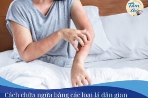 Cách chữa ngứa bằng các loại lá dân gian