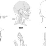 Chữa rối loạn tiền đình theo Đông y