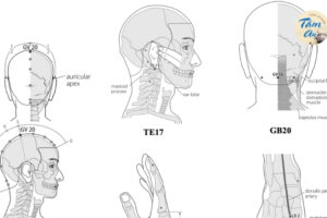Chữa rối loạn tiền đình theo Đông y