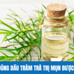 Có Thể Dùng Dầu Tràm Trà Trị Mụn Được Không?